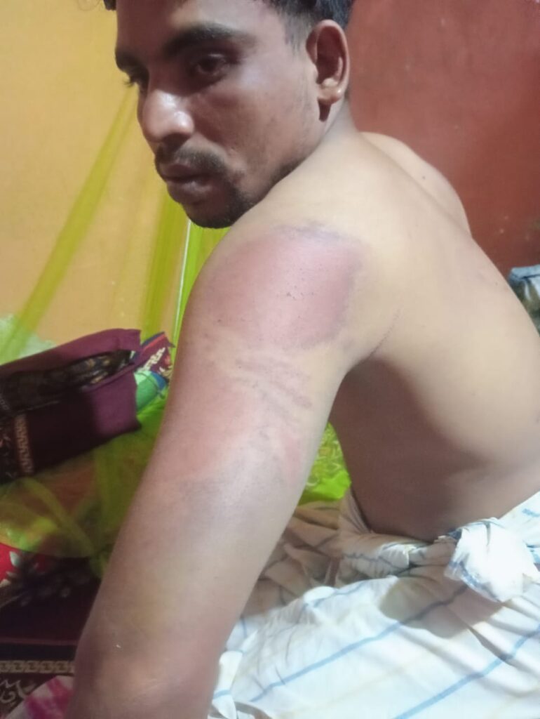 রূপগঞ্জে পাঠাও কর্মীকে আটকে রেখে মারধর, নগদ টাকা ও মালামাল ছিনতাই